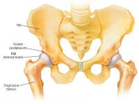 Legg-Calve-Perthes Disease